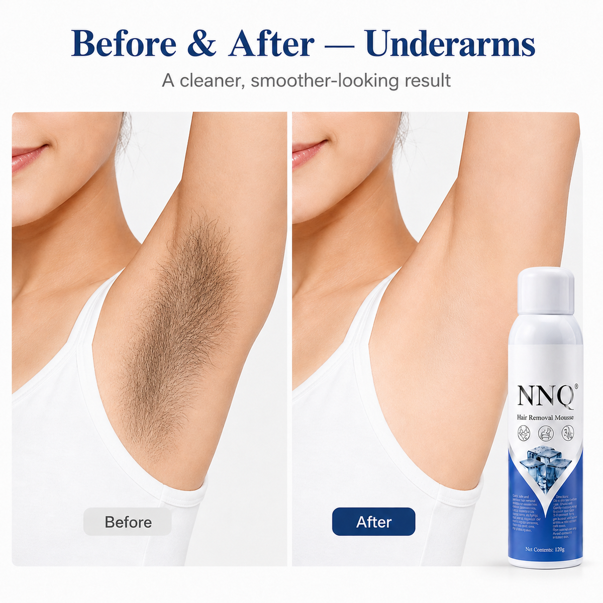 Hair Removal Spray for Men & Women +( Free Surprise  Gift Inside )