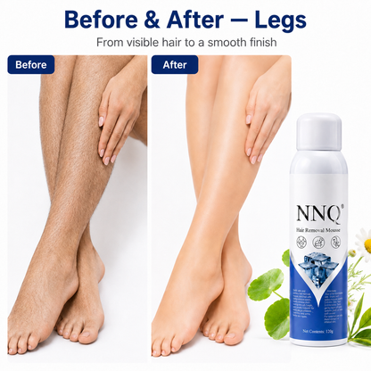 Hair Removal Spray for Men & Women +( Free Surprise  Gift Inside )