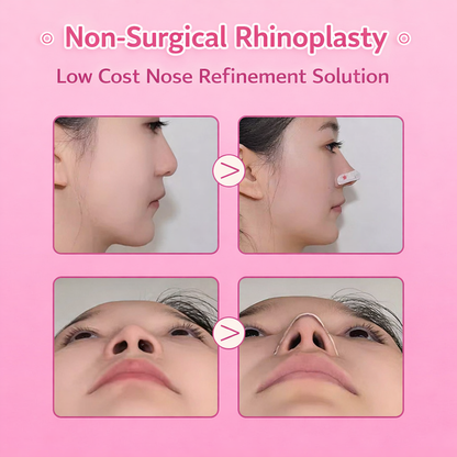 korean Nose Shappers
