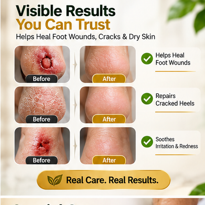 DermaHeal™
